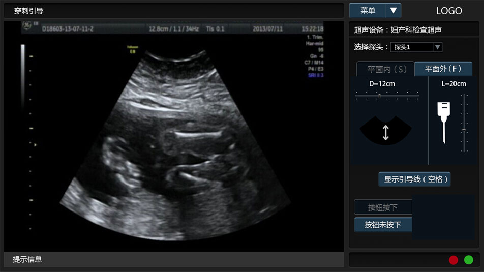 武漢睿影醫(yī)療科技超聲系統(tǒng)軟件界面設計